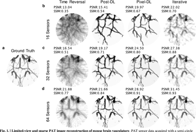 Figure 1 for Limited View and Sparse Photoacoustic Tomography for Neuroimaging with Deep Learning