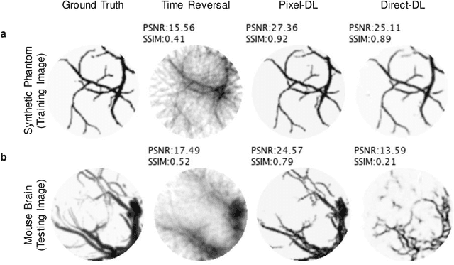 Figure 3 for Limited View and Sparse Photoacoustic Tomography for Neuroimaging with Deep Learning
