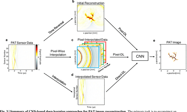 Figure 4 for Limited View and Sparse Photoacoustic Tomography for Neuroimaging with Deep Learning
