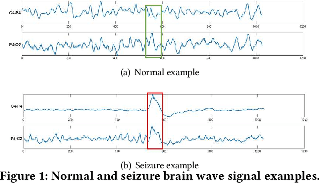 Figure 1 for Explainable Multivariate Time Series Classification: A Deep Neural Network Which Learns To Attend To Important Variables As Well As Informative Time Intervals