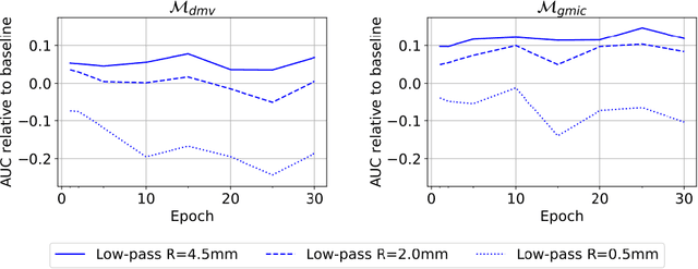 Figure 3 for Understanding the robustness of deep neural network classifiers for breast cancer screening