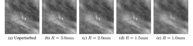 Figure 4 for Understanding the robustness of deep neural network classifiers for breast cancer screening