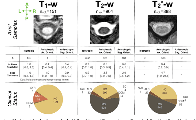 Figure 3 for Automatic segmentation of the spinal cord and intramedullary multiple sclerosis lesions with convolutional neural networks
