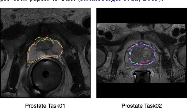 Figure 3 for Bayesian approaches for Quantifying Clinicians' Variability in Medical Image Quantification