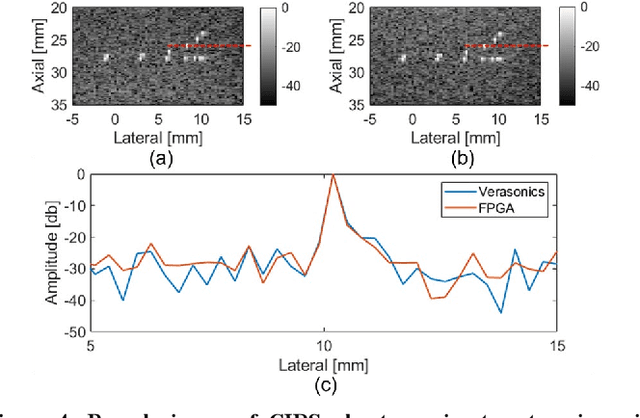 Figure 4 for Towards a real-time continuous ultrafast ultrasound beamformer with programmable logic