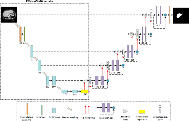 Figure 3 for EAR-U-Net: EfficientNet and attention-based residual U-Net for automatic liver segmentation in CT