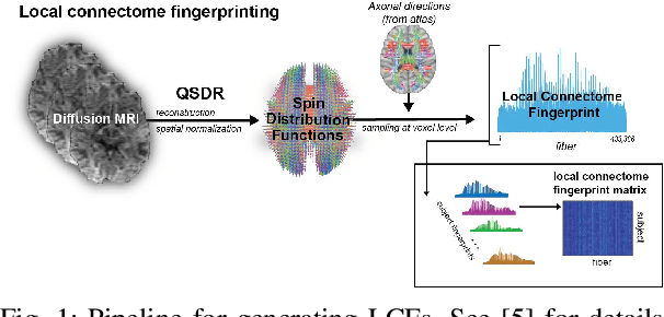 Figure 1 for Local White Matter Architecture Defines Functional Brain Dynamics