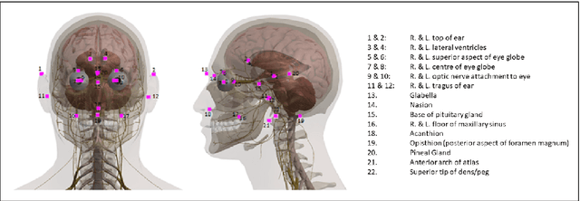 Figure 4 for Attaining human-level performance with atlas location autocontext for anatomical landmark detection in 3D CT data
