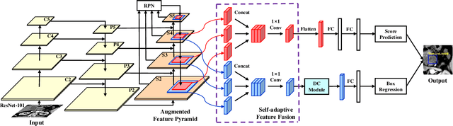 Figure 1 for A Novel and Efficient Tumor Detection Framework for Pancreatic Cancer via CT Images