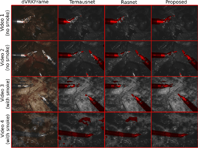 Figure 4 for Synthetic and Real Inputs for Tool Segmentation in Robotic Surgery