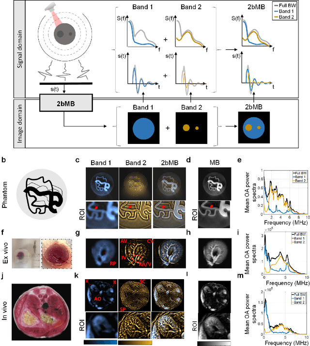 Figure 1 for Disentangling the frequency content in optoacoustics