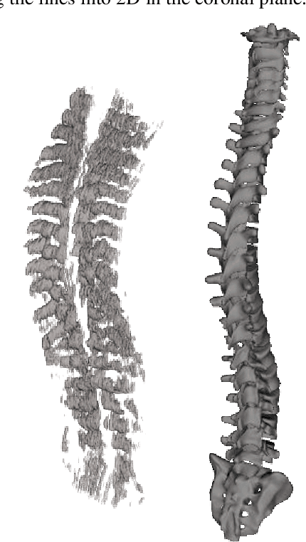 Figure 1 for Learning Generalized Non-Rigid Multimodal Biomedical Image Registration from Generic Point Set Data