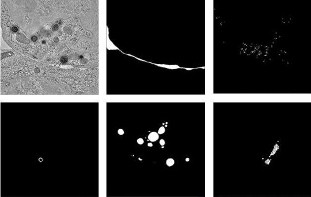 Figure 4 for SegET: Deep Neural Network with Rich Contextual Features for Cellular Structures Segmentation in Electron Tomography Image