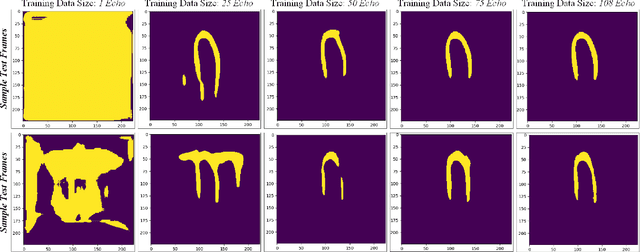 Figure 3 for Early Detection of Myocardial Infarction in Low-Quality Echocardiography