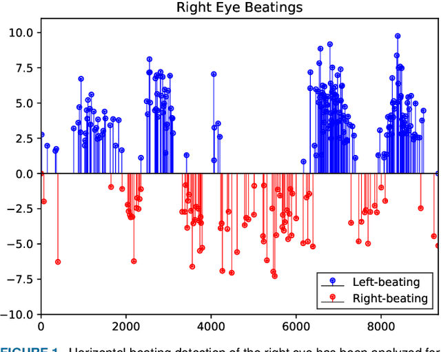 Figure 1 for LAD: A Hybrid Deep Learning System for Benign Paroxysmal Positional Vertigo Disorders Diagnostic