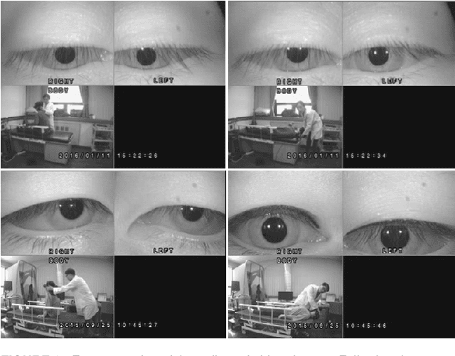 Figure 2 for LAD: A Hybrid Deep Learning System for Benign Paroxysmal Positional Vertigo Disorders Diagnostic