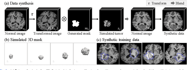 Figure 3 for Self-supervised Tumor Segmentation through Layer Decomposition