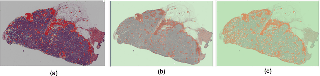 Figure 4 for Federated Learning for the Classification of Tumor Infiltrating Lymphocytes