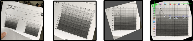 Figure 3 for Interpreting Audiograms with Multi-stage Neural Networks