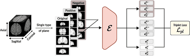 Figure 3 for Medical Transformer: Universal Brain Encoder for 3D MRI Analysis