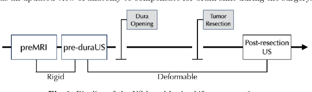 Figure 1 for A Feature-Driven Active Framework for Ultrasound-Based Brain Shift Compensation