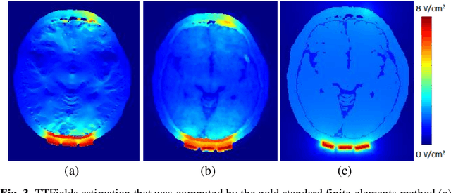 Figure 4 for A Method for Tumor Treating Fields Fast Estimation