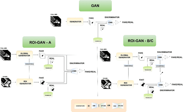 Figure 2 for A Generative Adversarial Model for Right Ventricle Segmentation