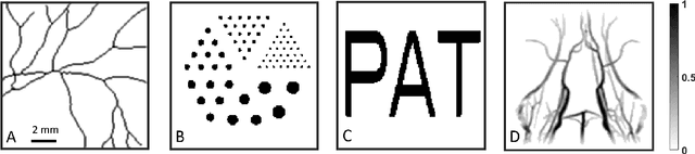 Figure 4 for PAT image reconstruction using augmented sparsity regularization with semi-automated tuning of regularization weight