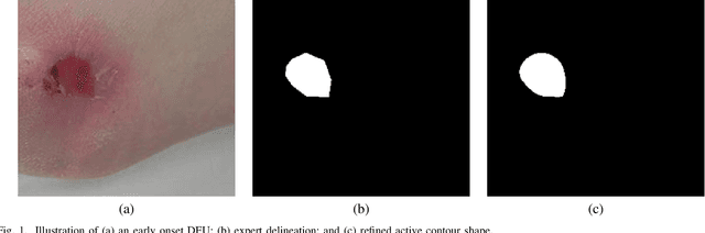 Figure 1 for Translating Clinical Delineation of Diabetic Foot Ulcers into Machine Interpretable Segmentation