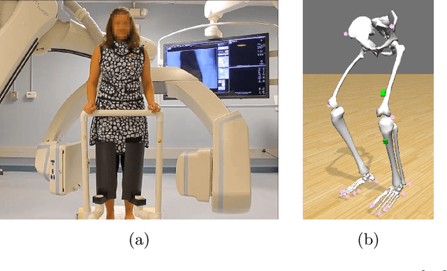 Figure 1 for Rigid and non-rigid motion compensation in weight-bearing cone-beam CT of the knee using  inertial measurements
