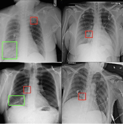 Figure 3 for Towards Trainable Saliency Maps in Medical Imaging
