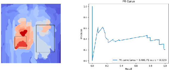 Figure 4 for Towards Trainable Saliency Maps in Medical Imaging