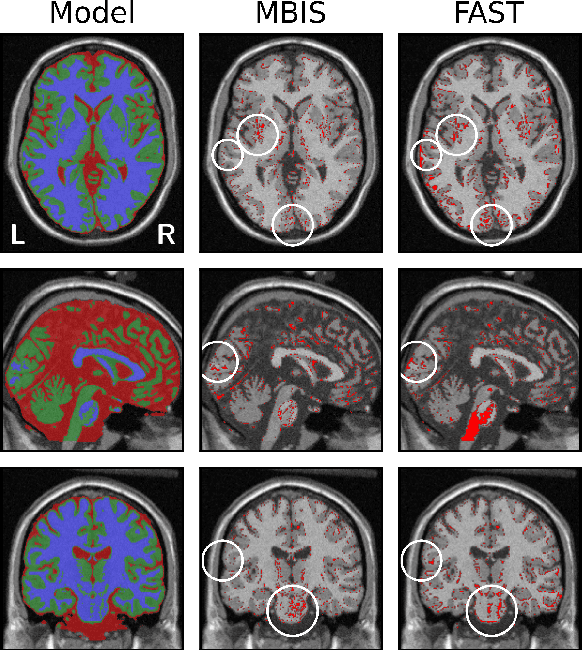 Figure 4 for MBIS: Multivariate Bayesian Image Segmentation Tool