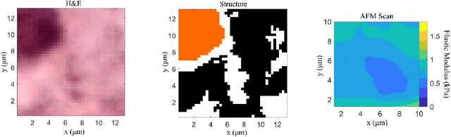 Figure 3 for Whole-Sample Mapping of Cancerous and Benign Tissue Properties