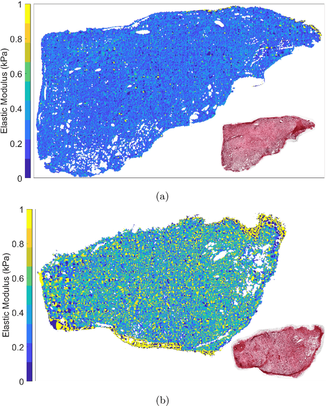 Figure 4 for Whole-Sample Mapping of Cancerous and Benign Tissue Properties