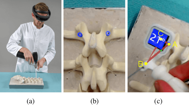 Figure 4 for Registration made easy -- standalone orthopedic navigation with HoloLens