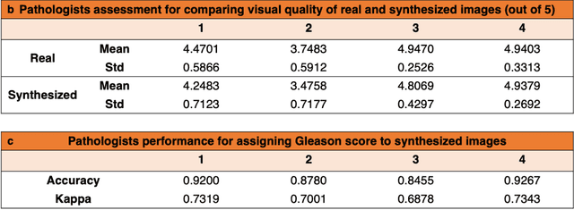 Figure 3 for Deepfake histological images for enhancing digital pathology