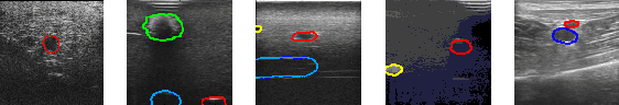 Figure 1 for A Study of Domain Generalization on Ultrasound-based Multi-Class Segmentation of Arteries, Veins, Ligaments, and Nerves Using Transfer Learning