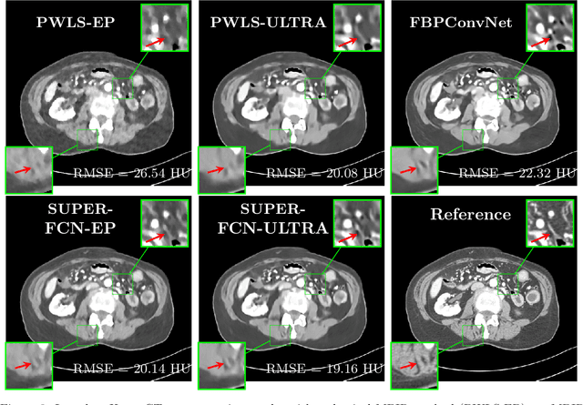 Figure 3 for Model-based Reconstruction with Learning: From Unsupervised to Supervised and Beyond
