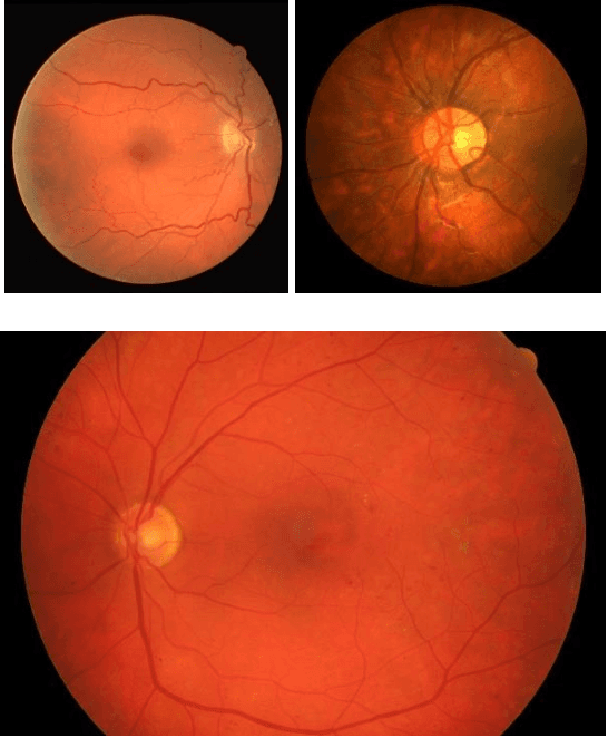 Figure 3 for HybridNetSeg: A Compact Hybrid Network for Retinal Vessel Segmentation