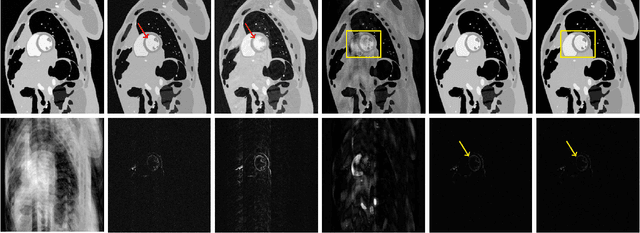 Figure 2 for Kernel Bi-Linear Modeling for Reconstructing Data on Manifolds: The Dynamic-MRI Case