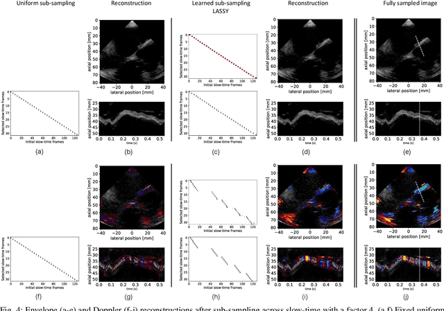 Figure 4 for Learning Sub-Sampling and Signal Recovery with Applications in Ultrasound Imaging