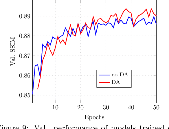 Figure 2 for Data augmentation for deep learning based accelerated MRI reconstruction with limited data
