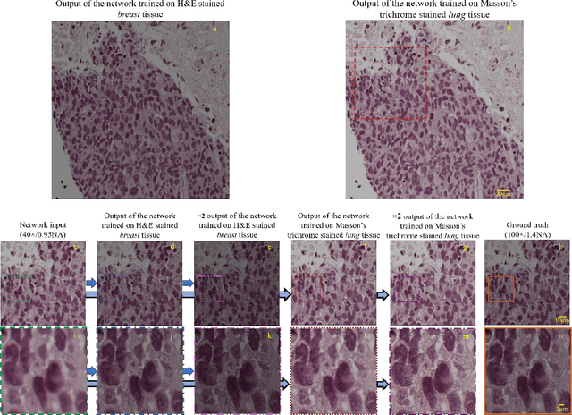 Figure 4 for Deep Learning Microscopy
