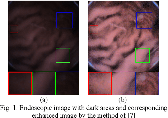 Figure 1 for A CNN-Based Blind Denoising Method for Endoscopic Images