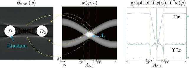 Figure 4 for CT sinogram-consistency learning for metal-induced beam hardening correction