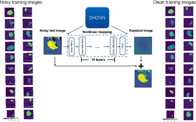 Figure 2 for Ultrasound Elasticity Imaging Using Physics-based Models And Learning-based Plug-And-Play Priors