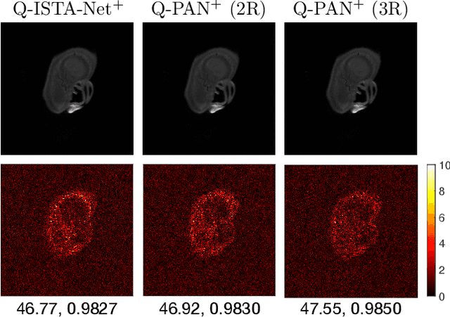 Figure 1 for Quantized Proximal Averaging Network for Analysis Sparse Coding