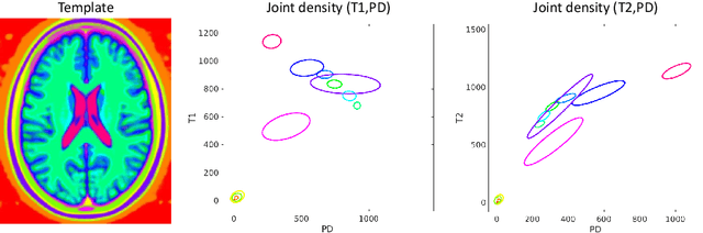 Figure 1 for Empirical Bayesian Mixture Models for Medical Image Translation