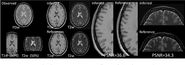 Figure 3 for Empirical Bayesian Mixture Models for Medical Image Translation